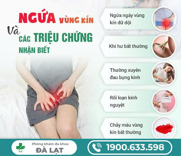 Hình ảnh minh họa